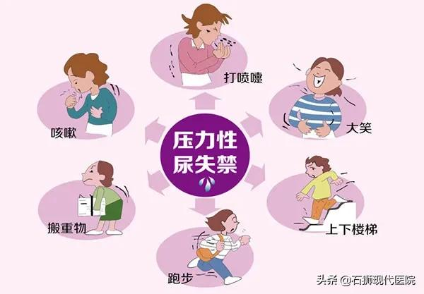 一笑就“湿身”?10几年痛苦一次解决