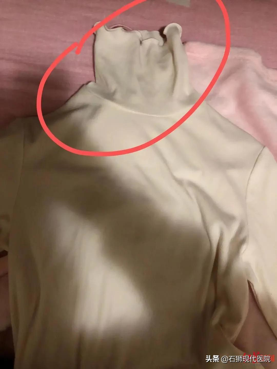 警惕!穿高领衣服会心悸、晕厥?可能是这种病