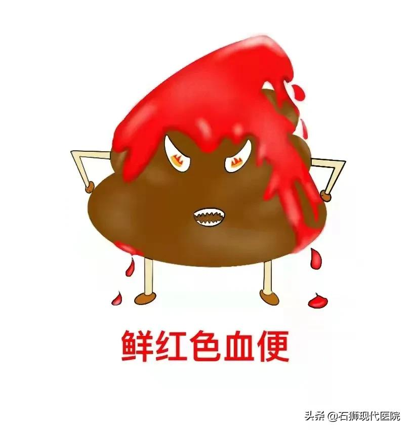 便血了可咋办!是痔疮还是癌?石狮肛肠外科专家教您“见色识病”