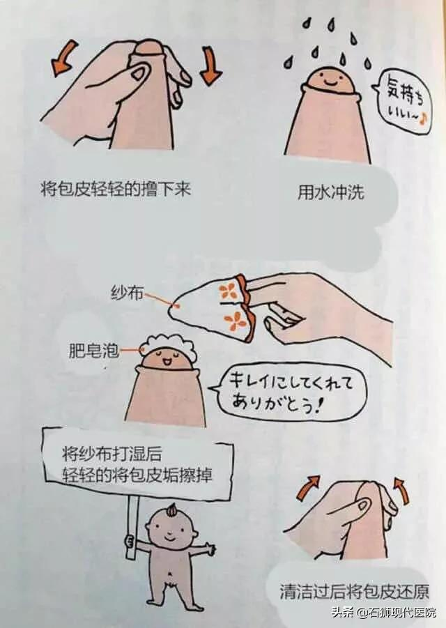 家长们看过来!孩子包皮长不长?割不割?看完你就懂了