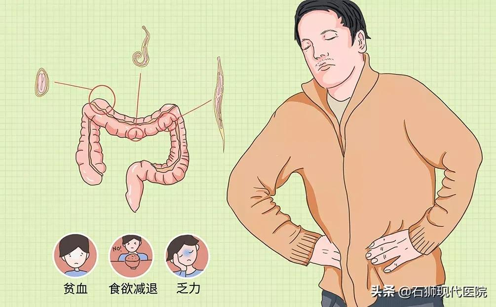 腹痛十余天,查出寄生虫感染