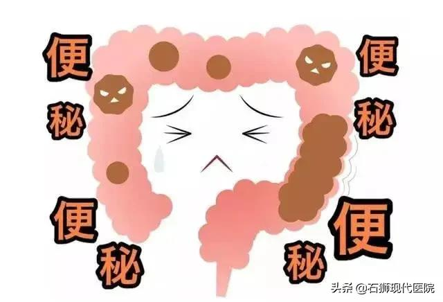 便秘如何治疗?点进来看如何解“秘”,一身轻松