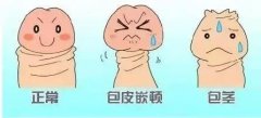 暑假期给孩子割包皮有什么好处？