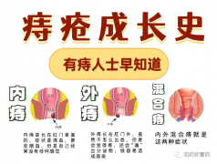 小痔疮，大危害！科普痔疮的八大危害