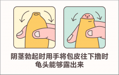 什么情况下需要进行包皮手术？做好这