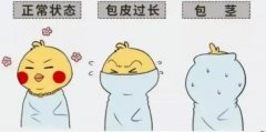 关于男性包皮手术，你关心的问题都在