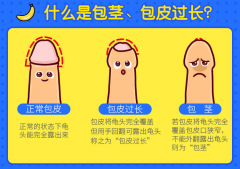 为什么要割包皮？割包皮有什么好处呢