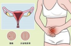 【健康科普】夏日炎炎，女性如何远离