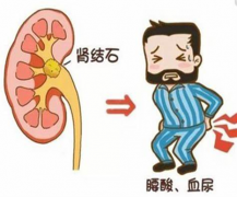 高温警报：超声如何揪出夏季“沉默的