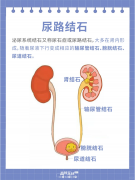 喝水吃饭有讲究：从根源上预防尿路结