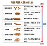 肛肠科专栏 | 便秘：“不翔”的感觉，