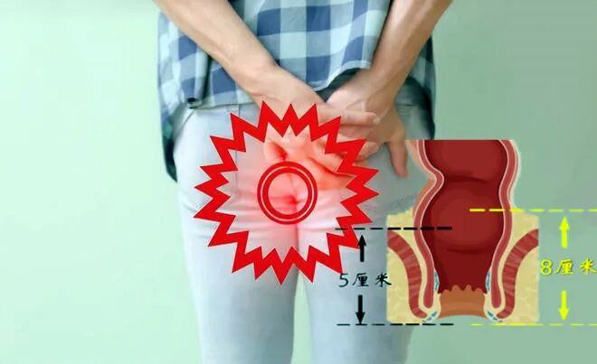 下载 - 2023-07.479.jpg