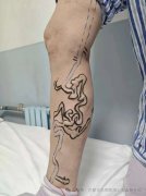 【石狮治疗静脉曲张医院】腿上“青筋