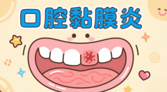 【石狮口腔医院】吃饭难受、说话都疼