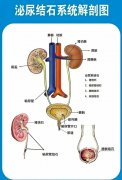 小结石，大危害！泌尿系结石的“隐形