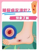 糖尿病足腿疼溃疡反反复复难以愈合，