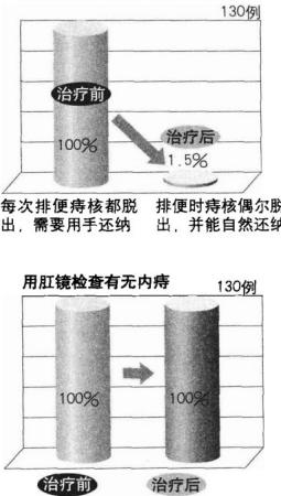 便血-排便时痔核脱出,需用手还纳