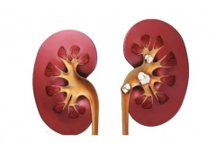 疼到直不起腰？小心身体里长了“小石