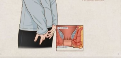 为什么肛门瘙痒绝对不能用手挠？因为